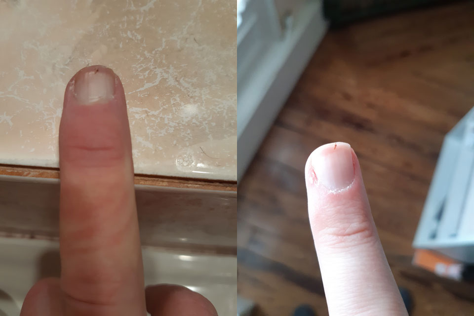 Deux photos de mon majeur
