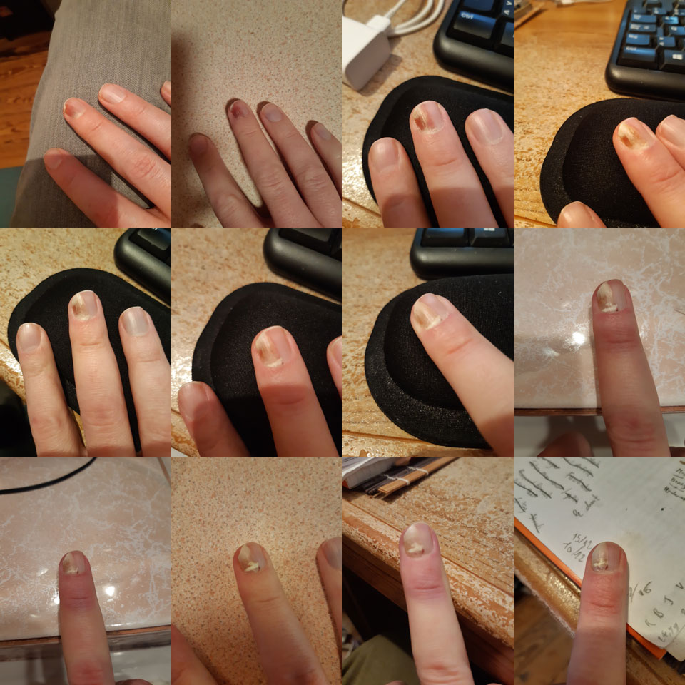 12 photos de mon doigt